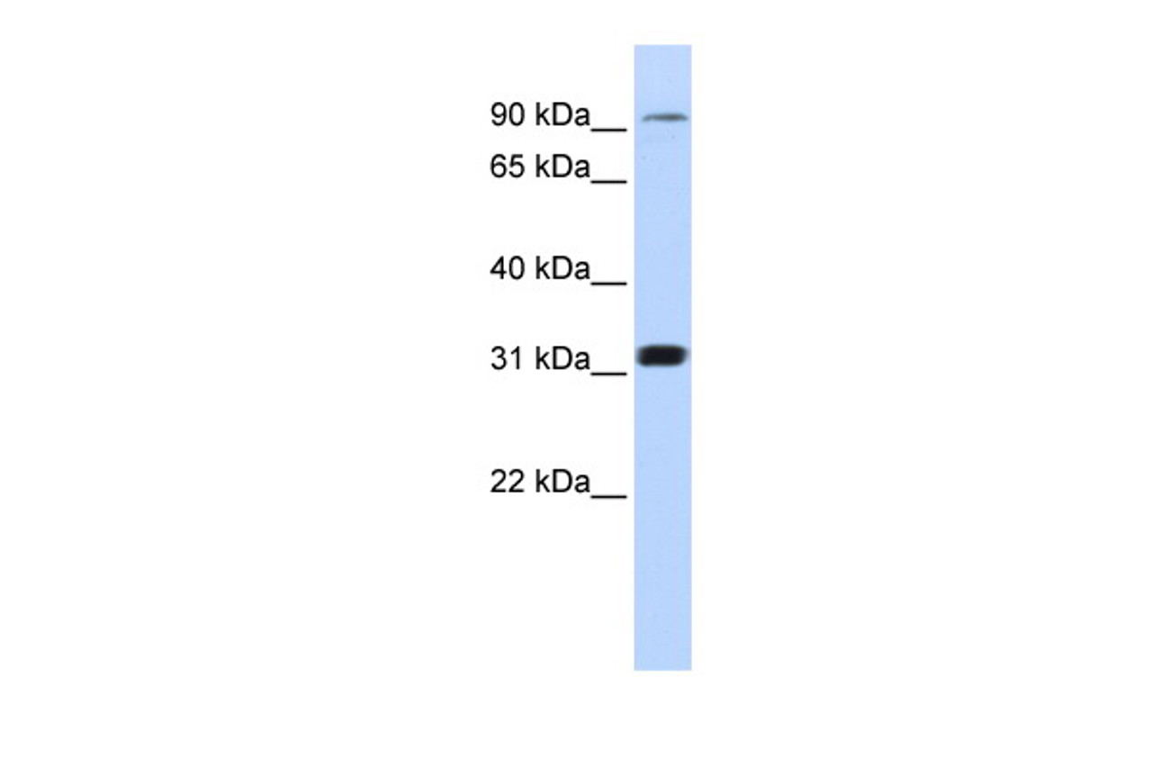 Antibody used in WB on Human 721_B at 0.2-1 ug/ml.