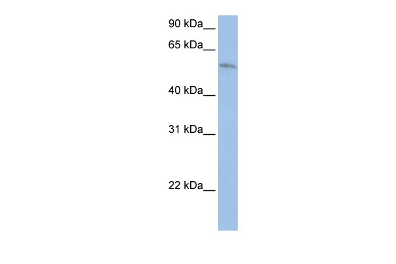 Antibody used in WB on Human HepG2 at 0.2-1 ug/ml.