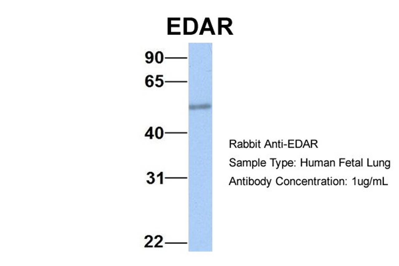 Antibody used in WB on Hum. Fetal Lung at 1 ug/ml.