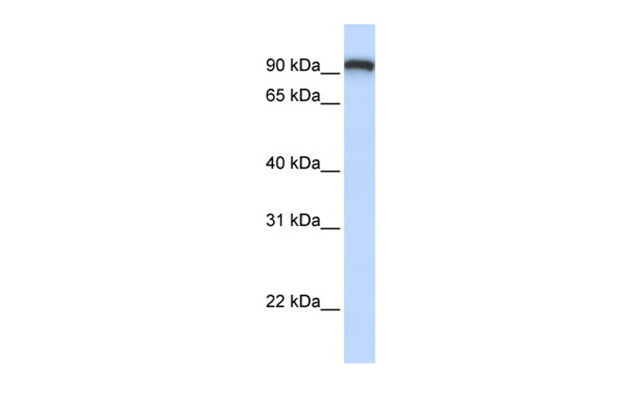 Antibody used in WB on Human MCF-7 at 0.2-1 ug/ml.