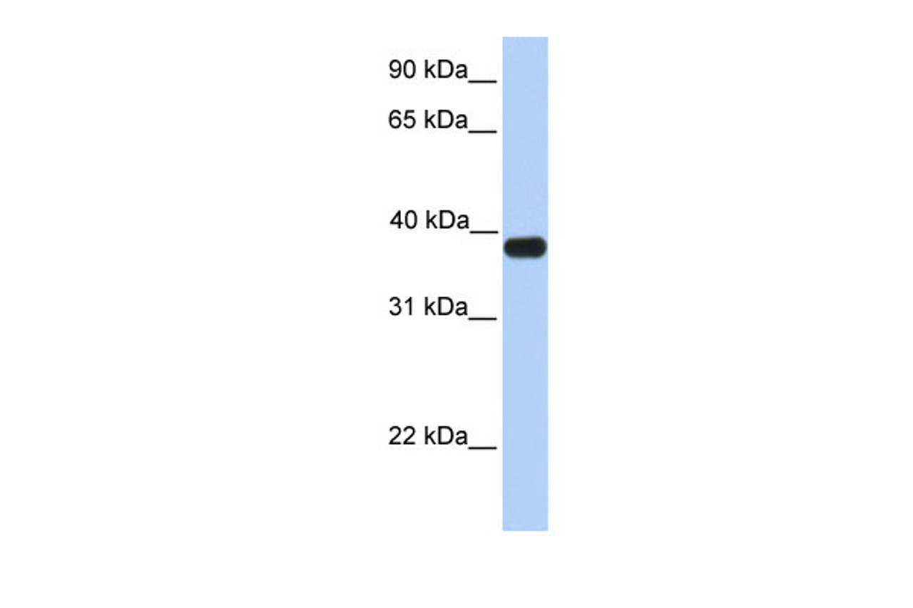 Antibody used in WB on Human Muscle at 0.2-1 ug/ml.