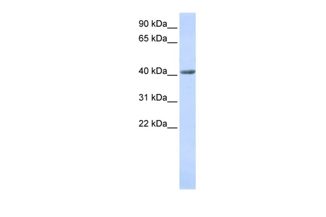 Antibody used in WB on Human Stomach at 0.2-1 ug/ml.