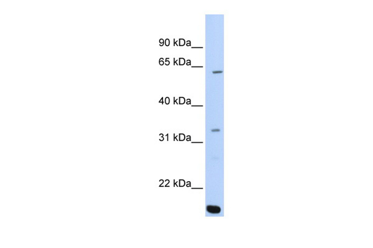 Antibody used in WB on Human 721_B at 0.2-1 ug/ml.