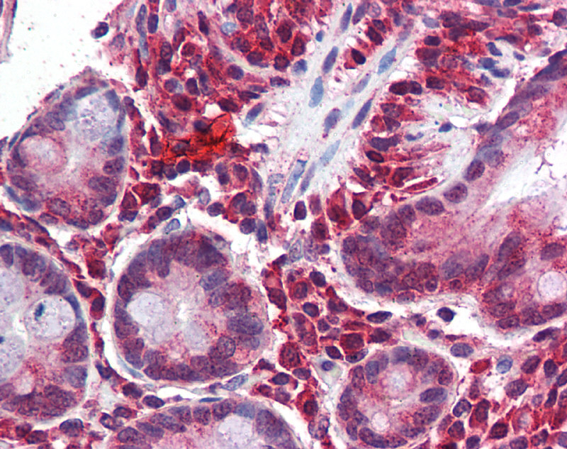 Antibody used in IHC on Human Small intestine.