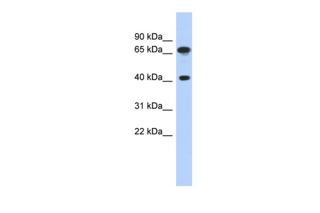 Antibody used in WB on Human THP-1 at 1 ug/ml.