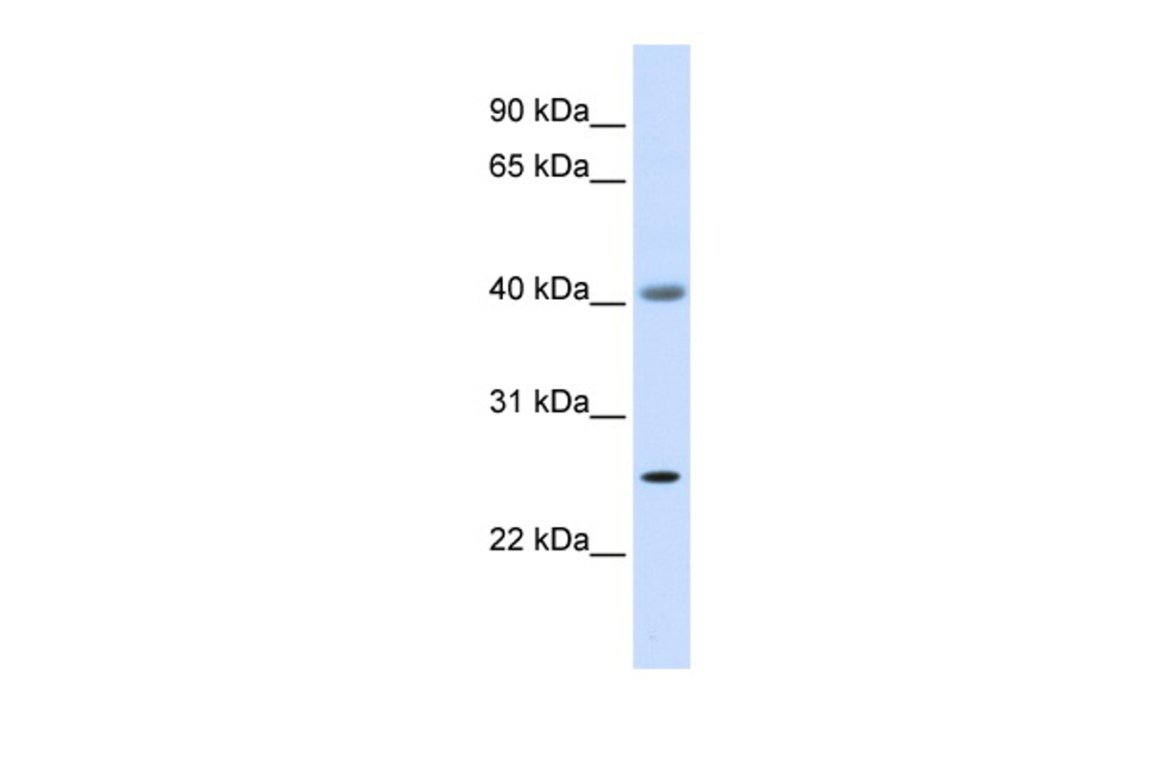 Antibody used in WB on Human Muscle at 0.2-1 ug/ml.
