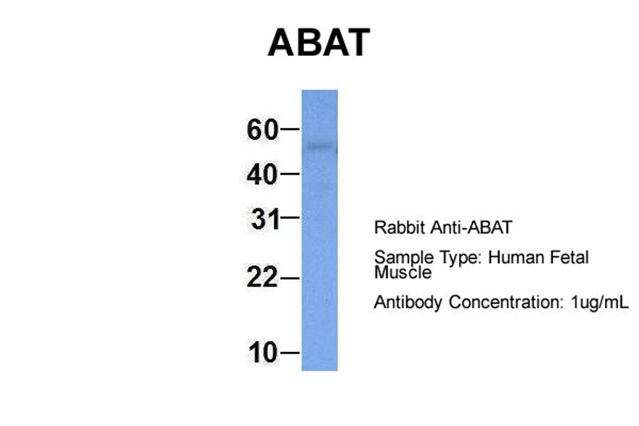 Antibody used in WB on Hum. Fetal Muscle at 1 ug/ml.