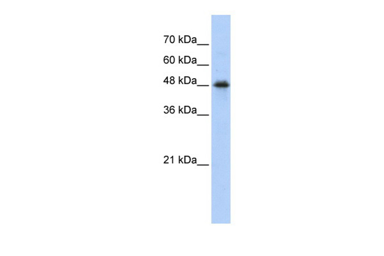 Antibody used in WB on Transfected 293T at 0.2-1 ug/ml.