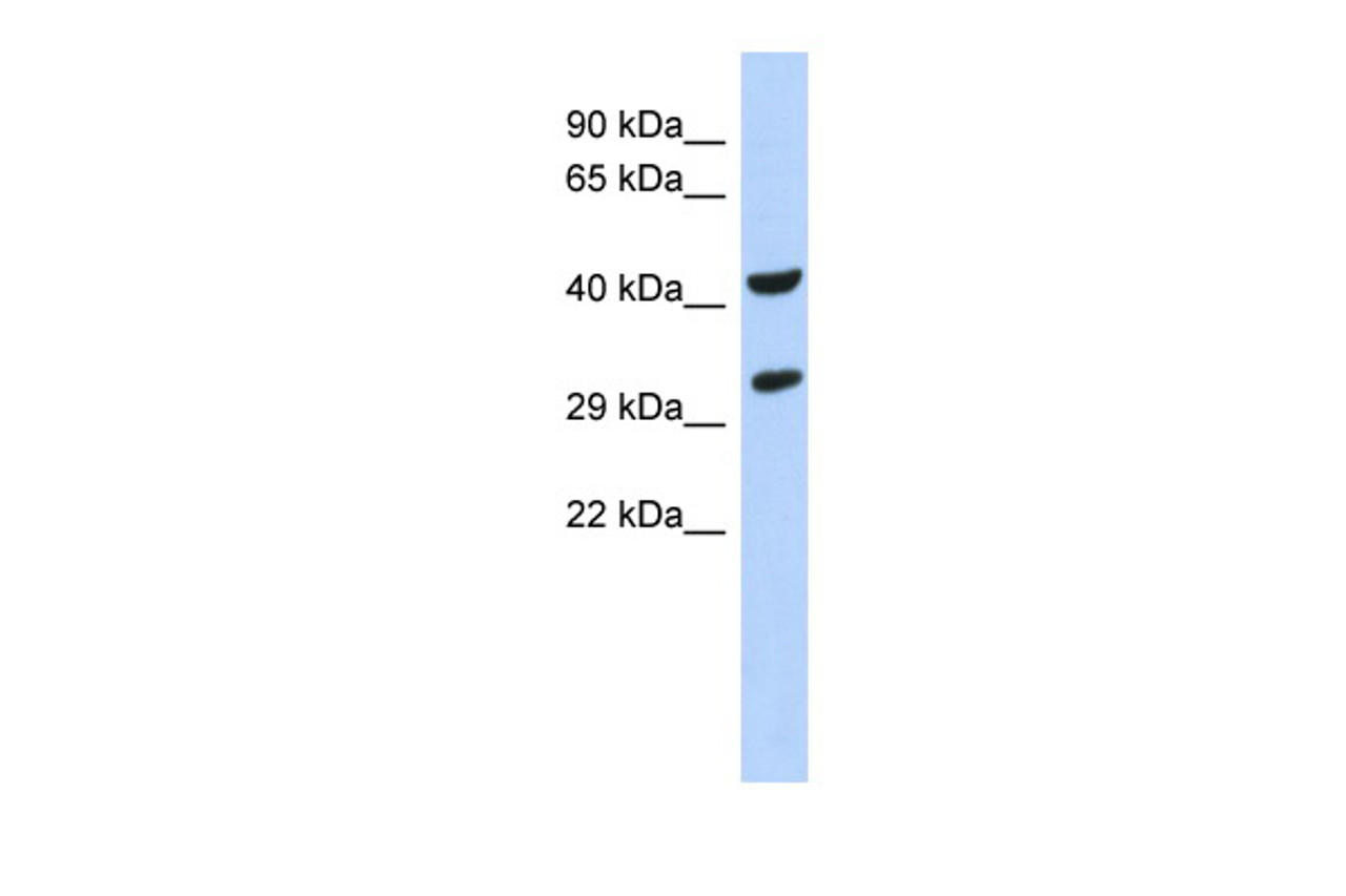Antibody used in WB on Human Pancreas at 0.2-1 ug/ml.
