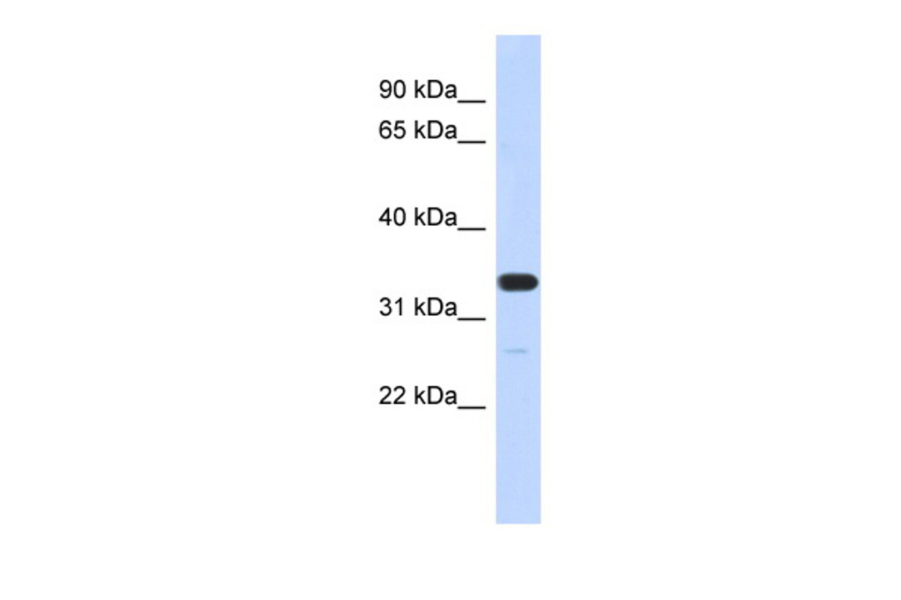 Antibody used in WB on Human MCF-7 at 0.2-1 ug/ml.