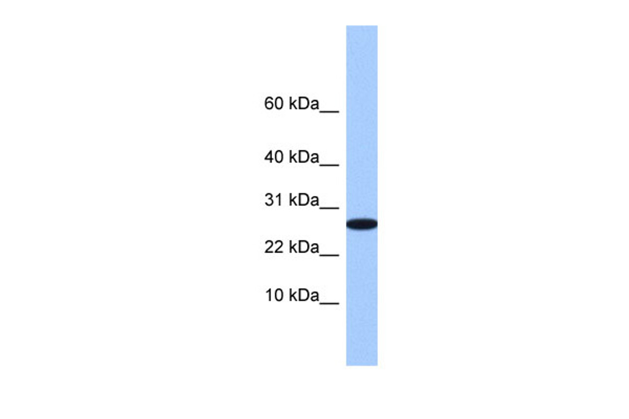 Antibody used in WB on Human 721_B at 0.2-1 ug/ml.