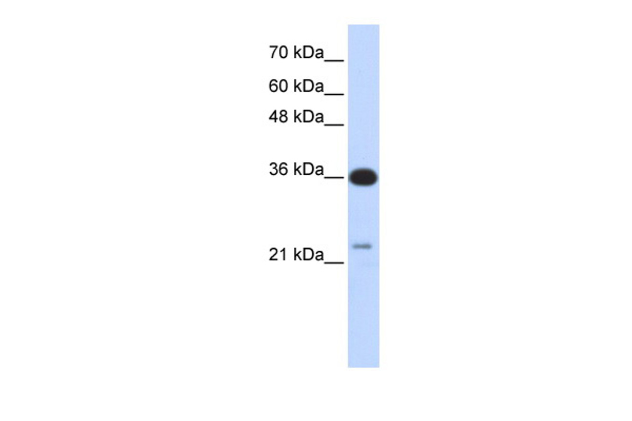 Antibody used in WB on Transfected 293T at 0.2-1 ug/ml.