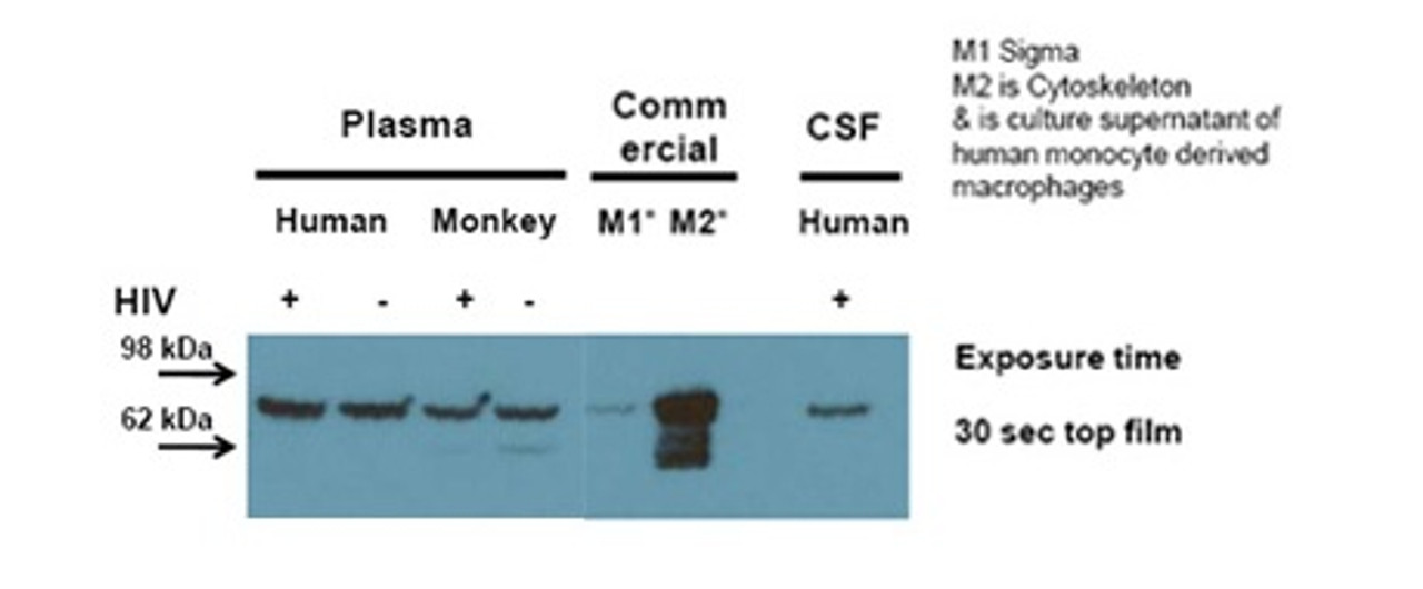 Antibody used in WB on Human Tonsil.