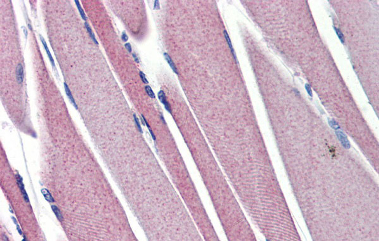 Antibody used in IHC on Human Skeletal Muscle at 5.0 ug/ml.