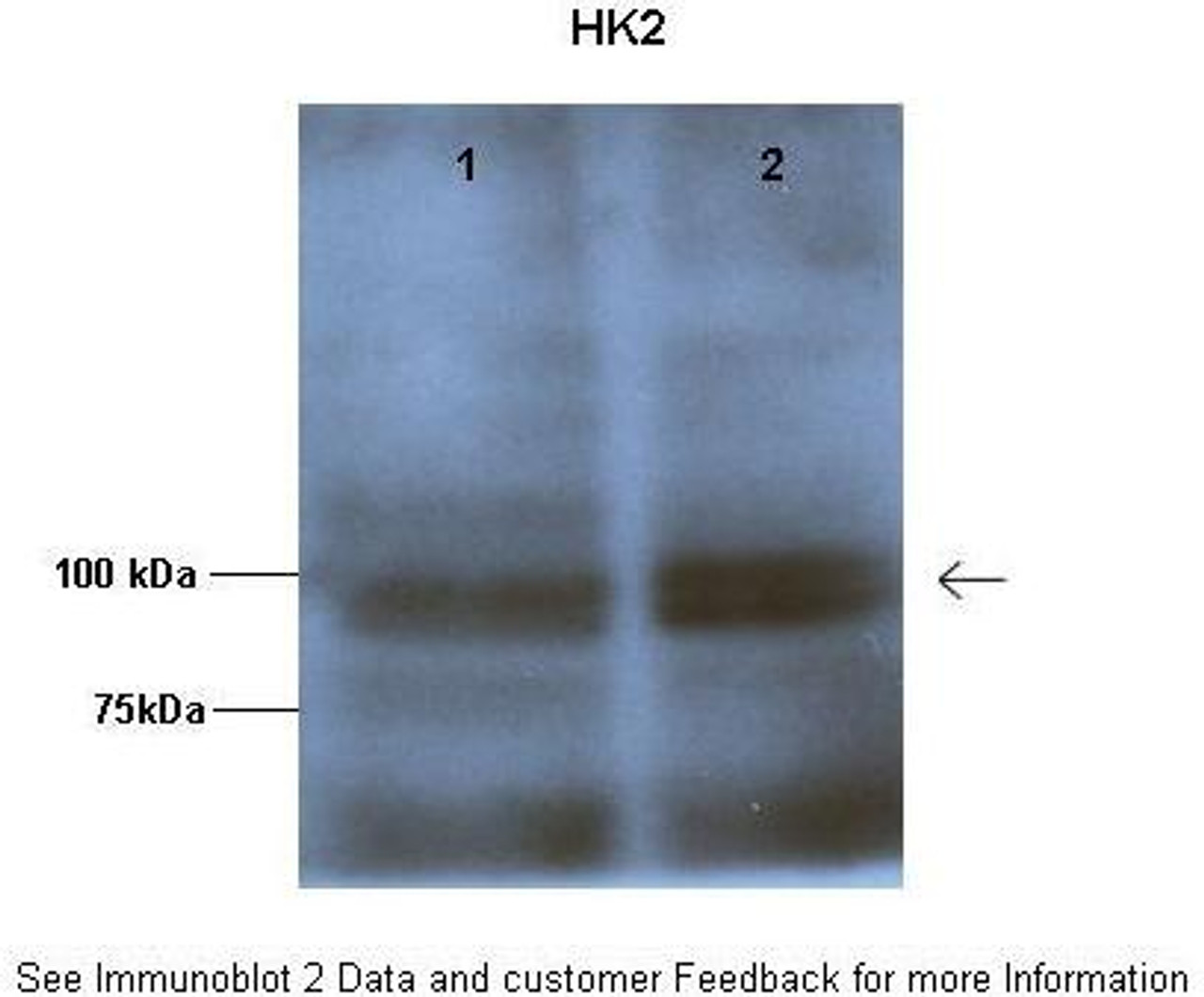 Antibody used in WB on Human HEP3B at: 1:1000 (Lane 1: 50 ug HEP3B lysate, Lane 2: 50 ug HEP3B lysate) .