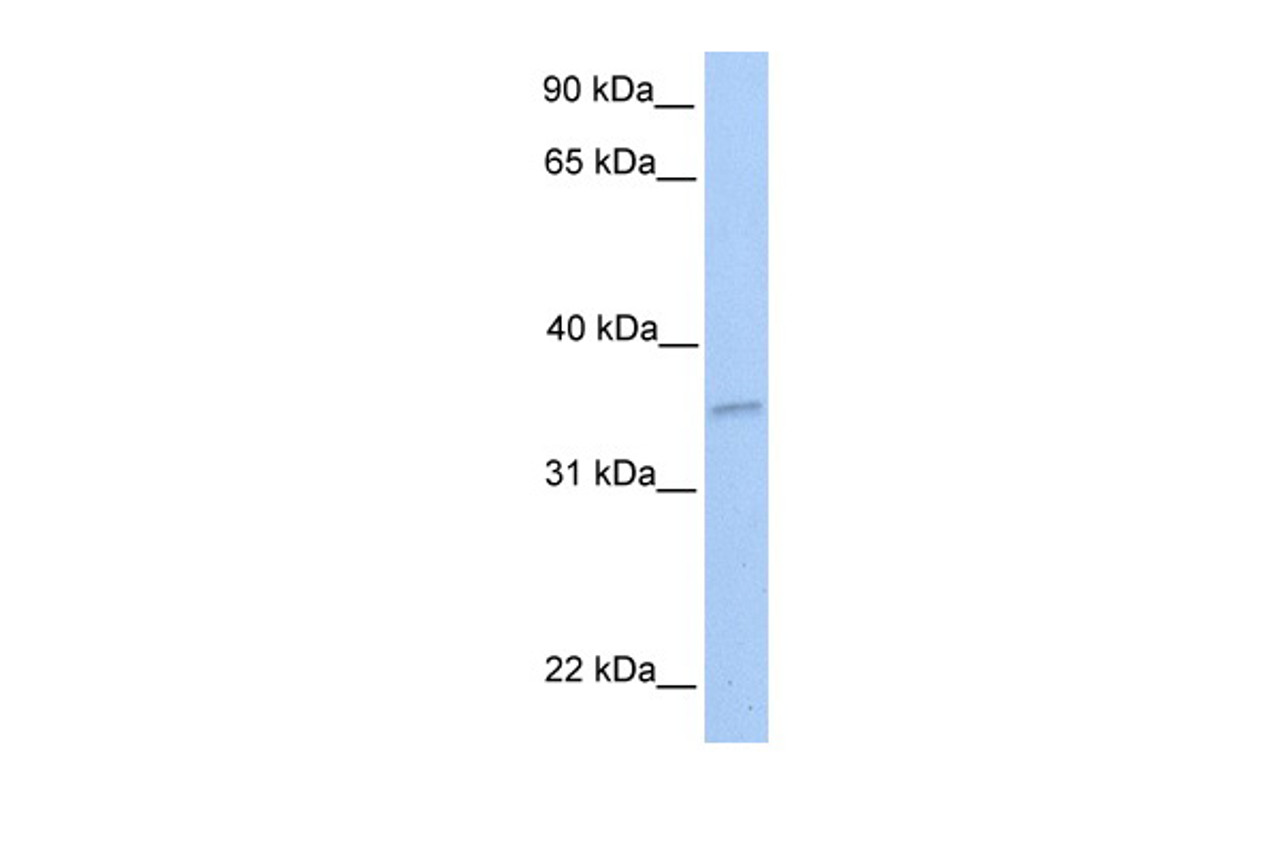 Antibody used in WB on Human 721_B cells at 0.2-1 ug/ml.