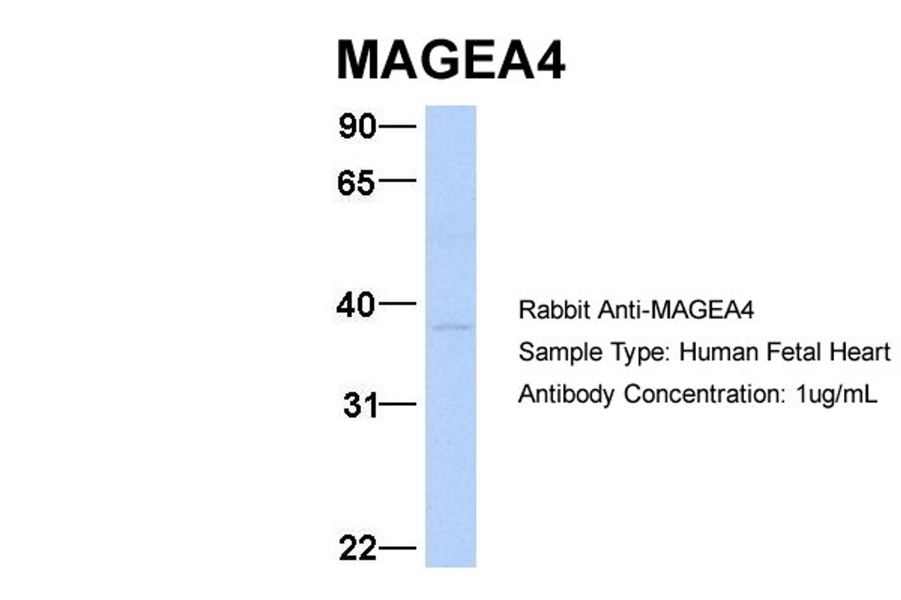 Antibody used in WB on Hum. Fetal Heart at 1 ug/ml.