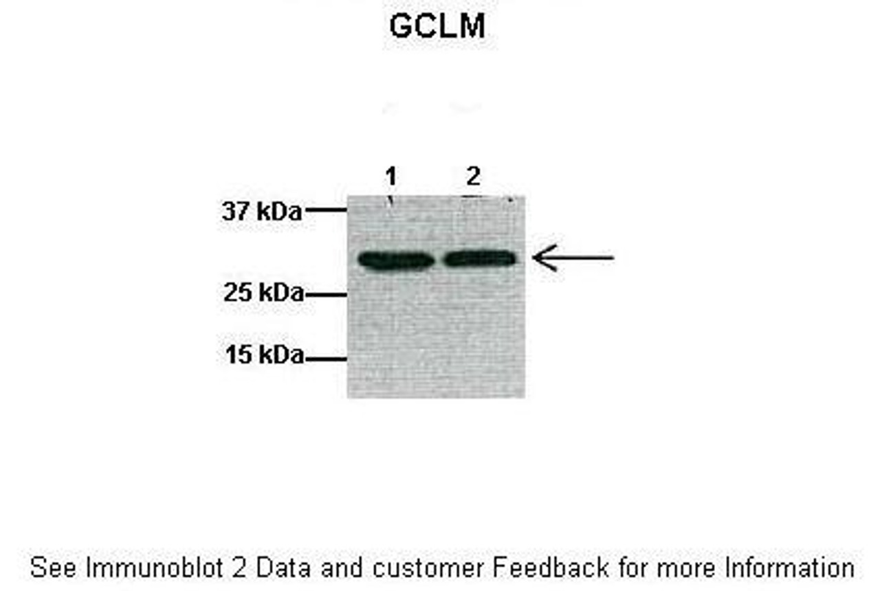 Antibody used in WB on Mouse heart at: 1:1000 (Lane 1: 40ug mouse heart lysate, Lane 2: 40ug mouse heart lysate) .