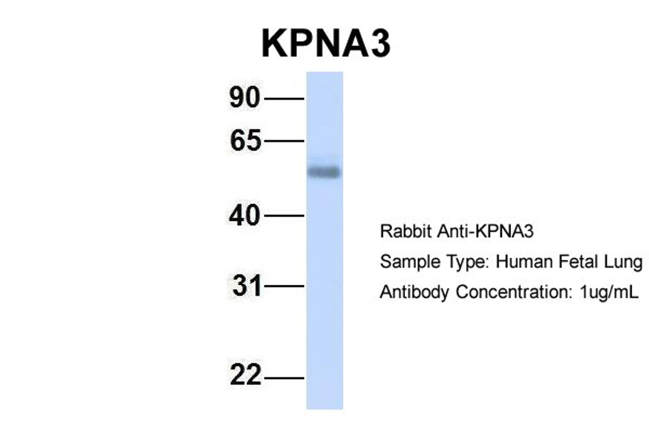 Antibody used in WB on Hum. Fetal Lung at 1 ug/ml.