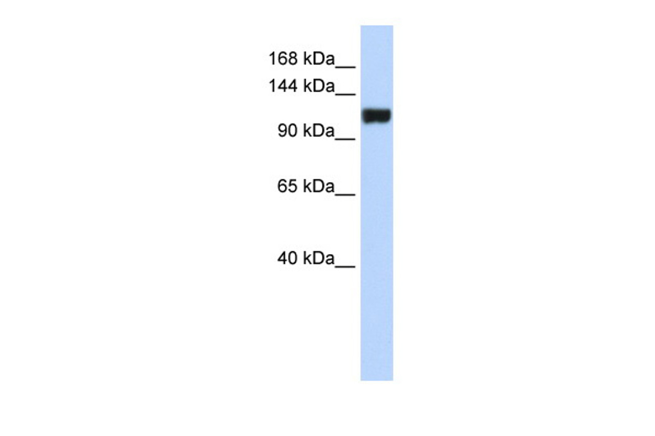 Antibody used in WB on Human MCF-7 at 0.2-1 ug/ml.