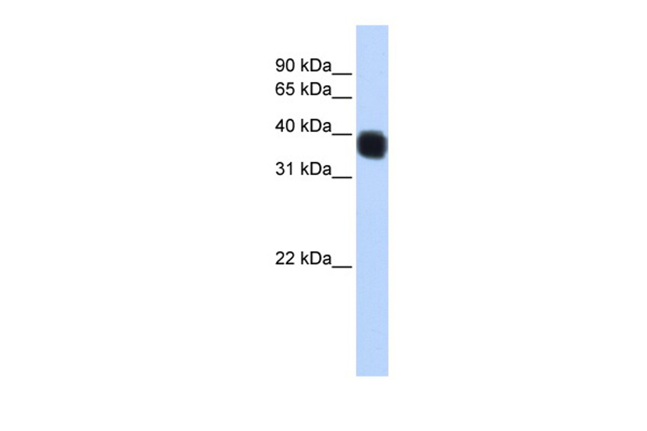 Antibody used in WB on Human MCF-7 at 0.2-1 ug/ml.