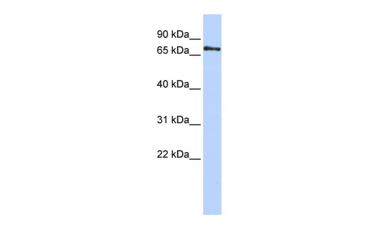 Antibody used in WB on Human Jurkat 0.2-1 ug/ml.