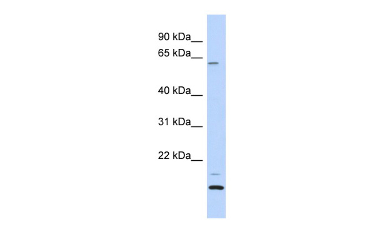 Antibody used in WB on Human Heart at 0.2-1 ug/ml.