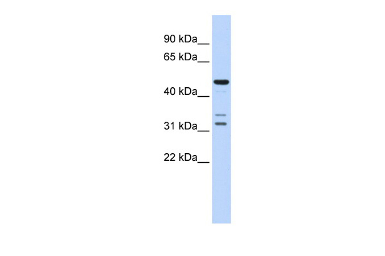 Antibody used in WB on Human Brain at 0.2-1 ug/ml.