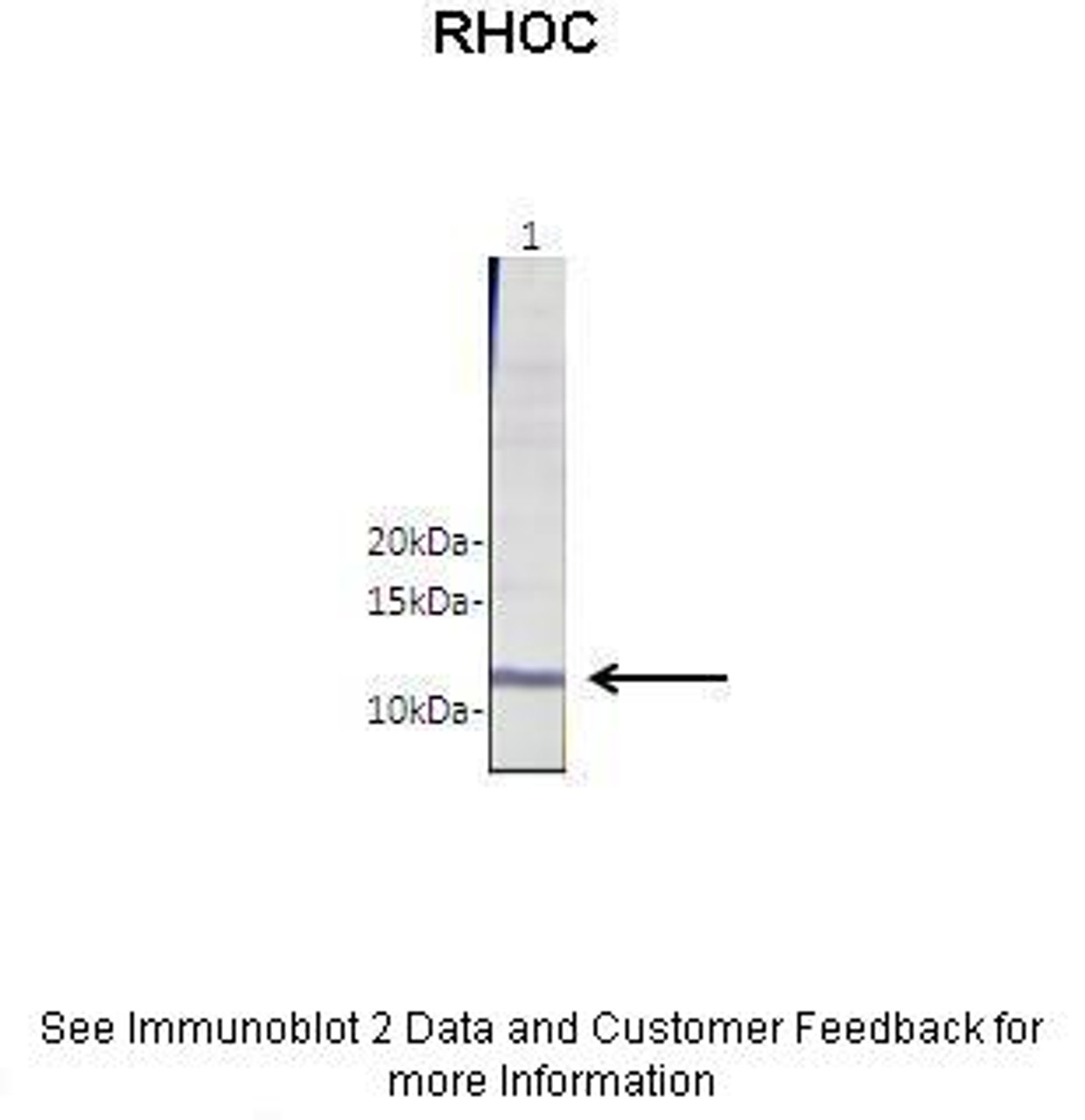 Antibody used in WB on Brugia malayi extract at: 1:1000.