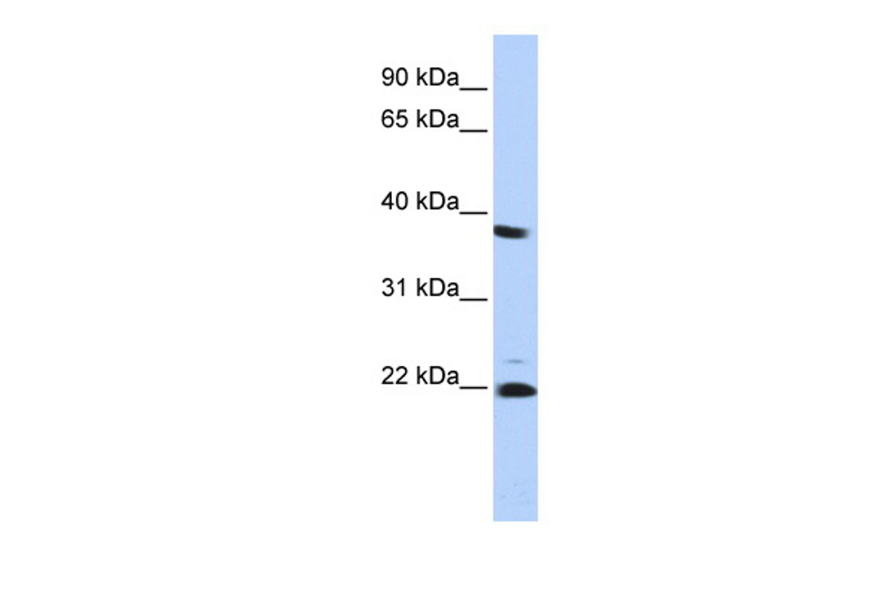 Antibody used in WB on Human HepG2 at 0.2-1 ug/ml.