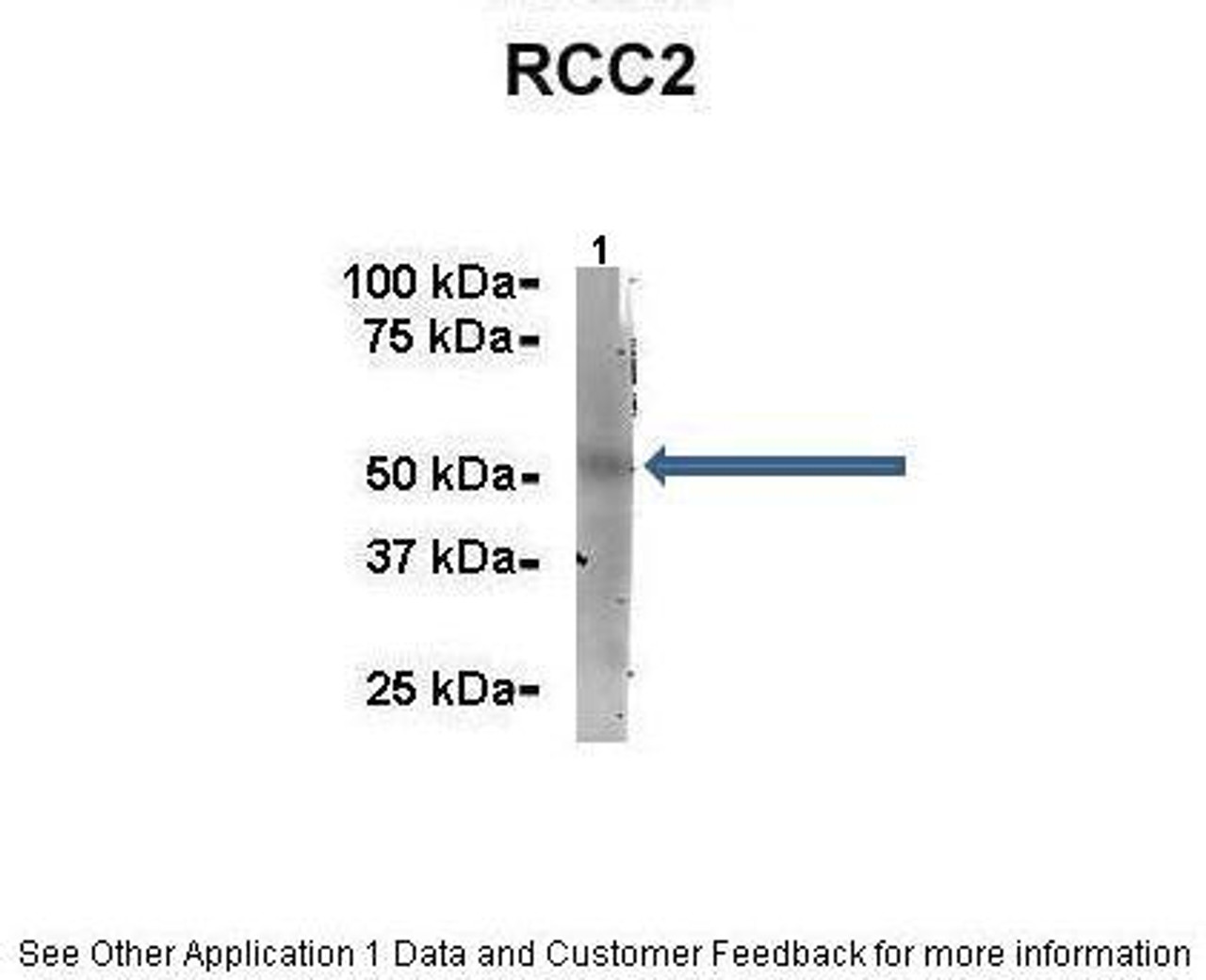 Antibody used in IP on Mouse brain at 1:500.