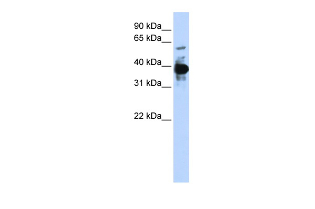 Antibody used in WB on Human 293T at 0.2-1 ug/ml.