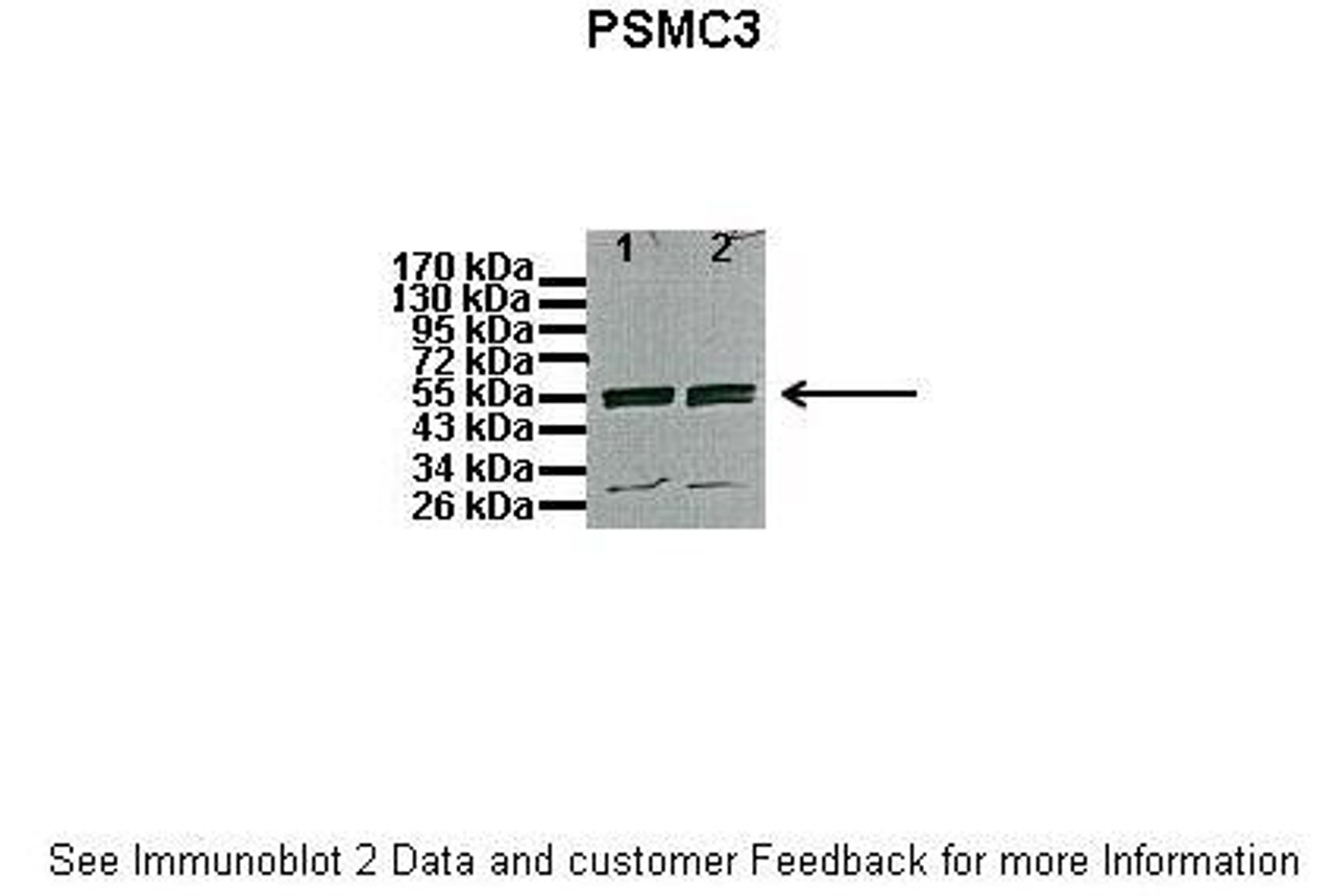 Antibody used in WB on Mouse brain at: 1:500 (Lanes: 1: 10ug proteasome fraction from C57B1/6J mouse brain, 2: 10ug proteasome fraction from BLAB/C mouse brain) .