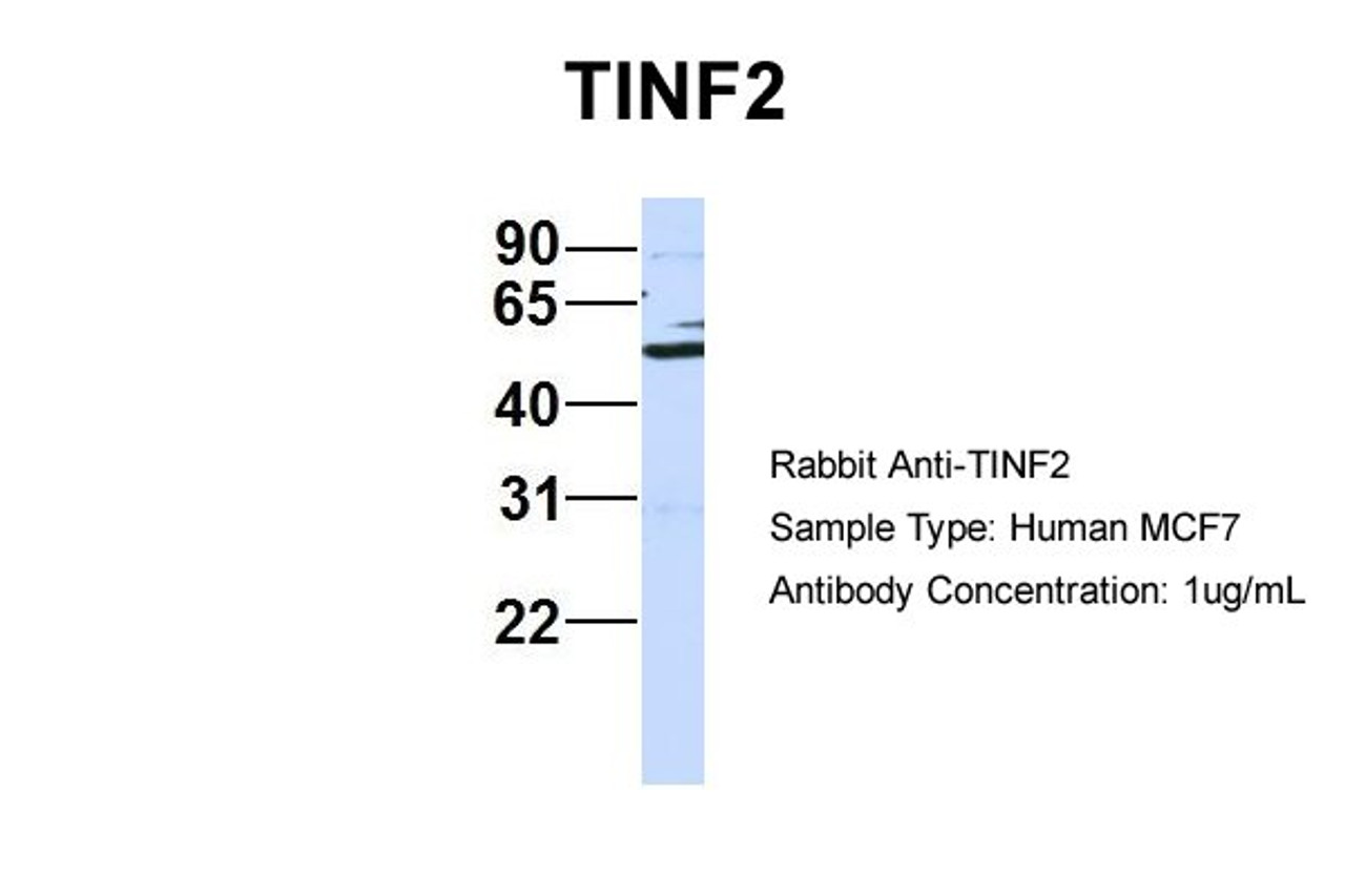 Antibody used in WB on Human MCF7 at 1 ug/ml.