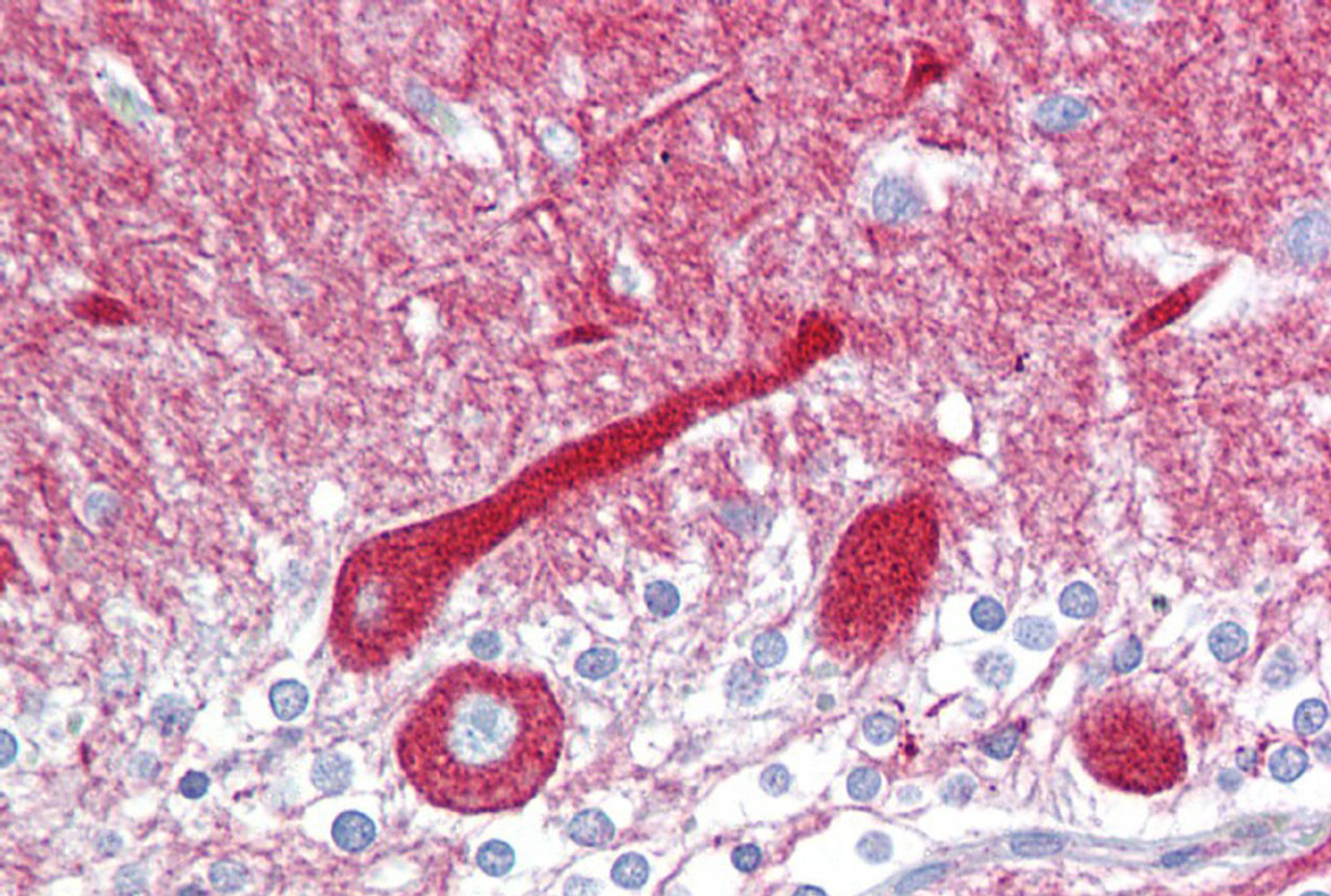 Antibody used in IHC on Human Brain at 5 ug/ml.