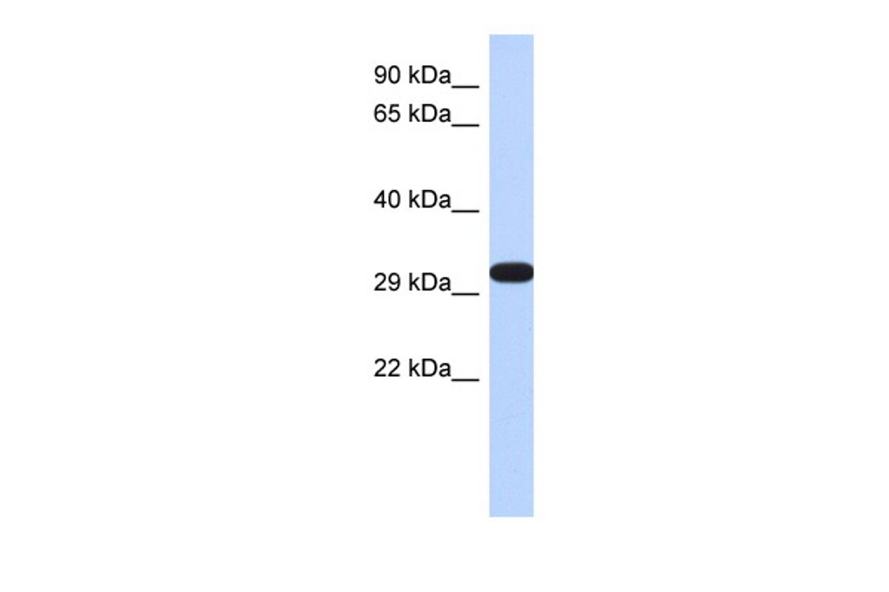 Antibody used in WB on Human Fetal Brain at 1 ug/ml.