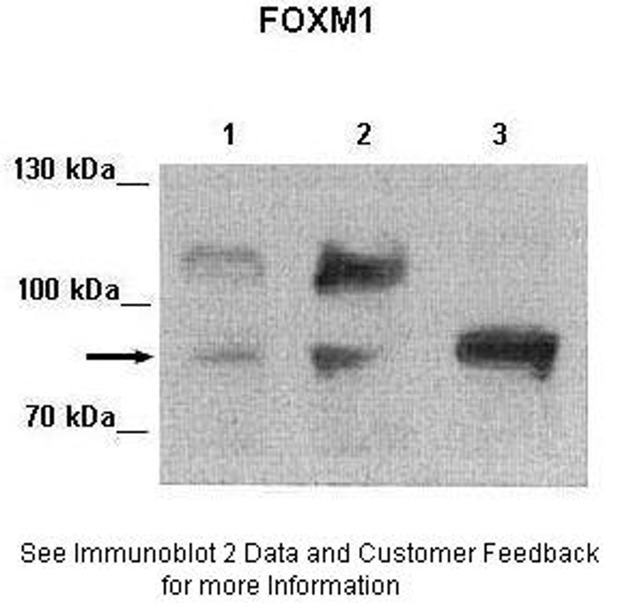 Antibody used in WB on Human cell lines at: 1:2000 (Lane 1: 25ug MIA PaCa-2 human pancreatic cancer cell line, Lane 2: 25ug MDA-MB-231 cell lysate, Lane 3: 25ug Huh-7 cell lysate) .