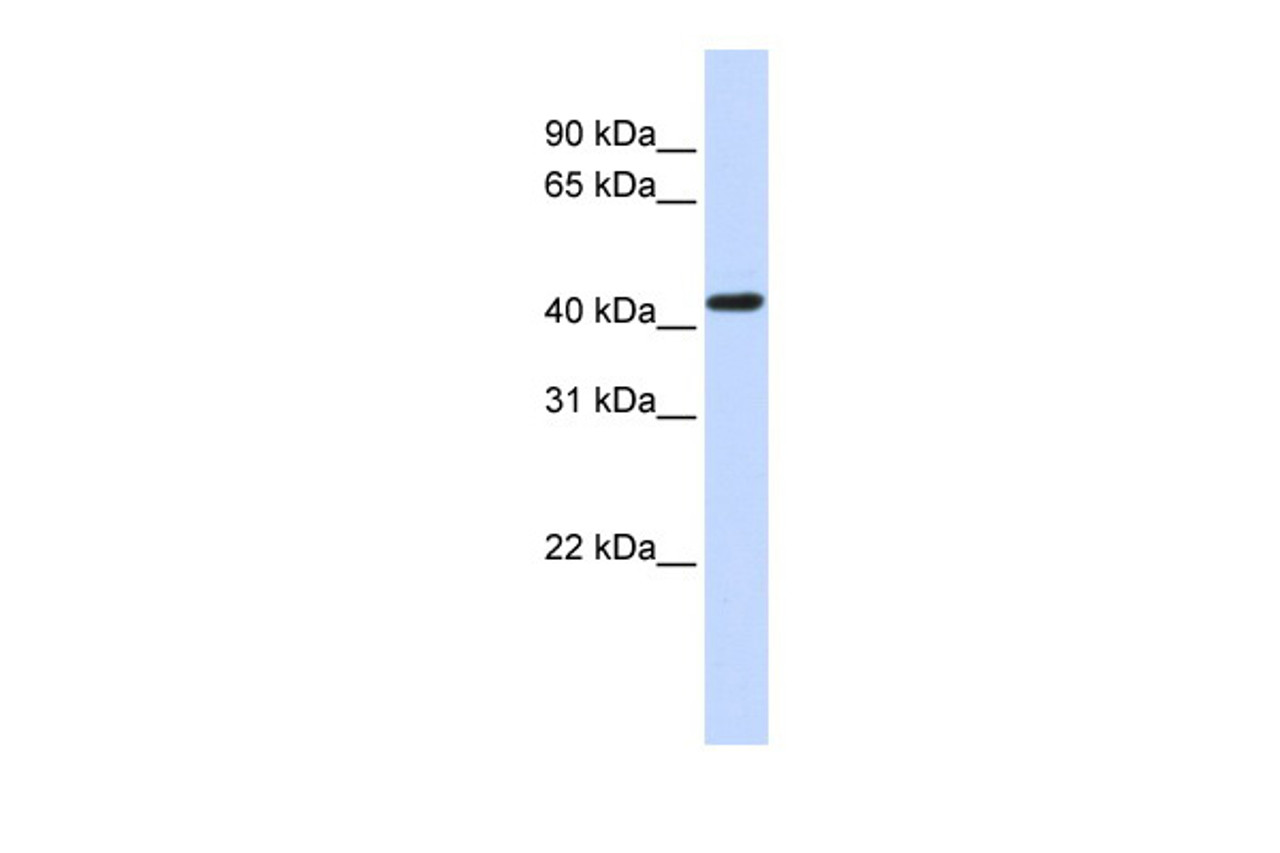 Antibody used in WB on Human Brain at 0.2-1 ug/ml.