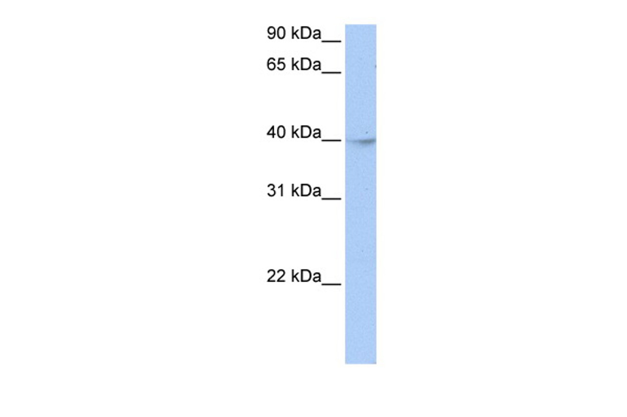 Antibody used in WB on Human HepG2 at 0.2-1 ug/ml.