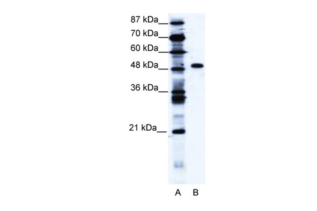 Antibody used in WB on Human Jurkat 1.25 ug/ml.