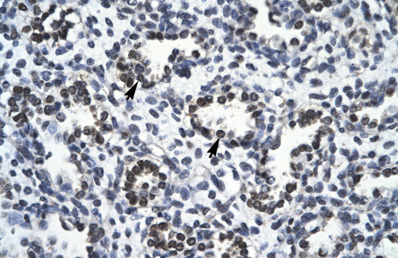 Antibody used in IHC on Human Lung at 4.0-8.0 ug/ml.