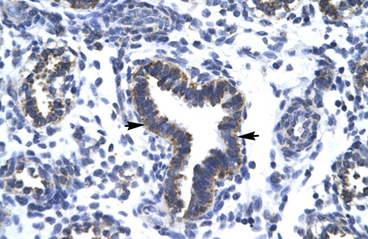 Antibody used in IHC on Human Lung at 4.0-8.0 ug/ml.