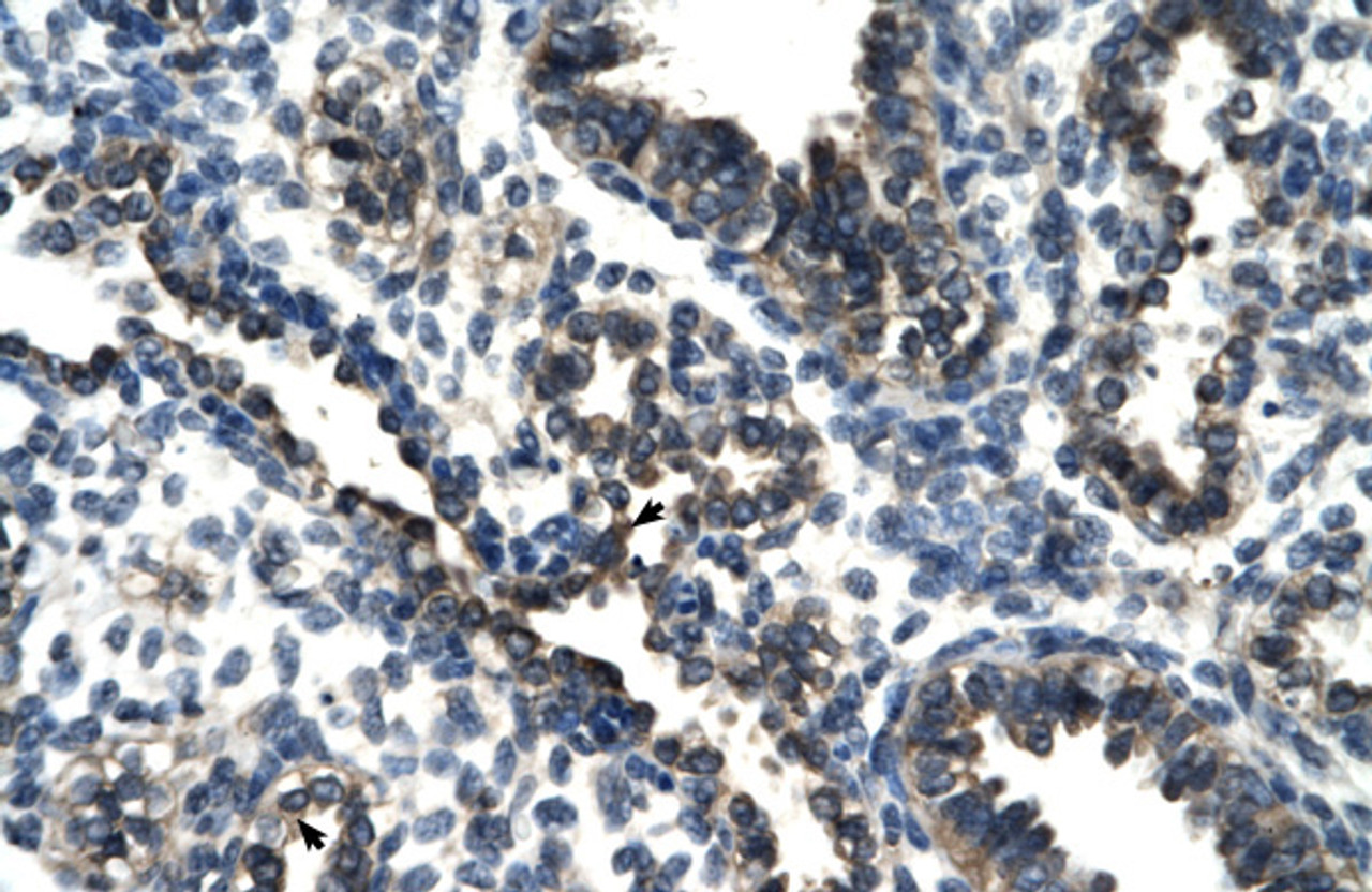 Antibody used in IHC on Human Lung at 4.0-8.0 ug/ml.