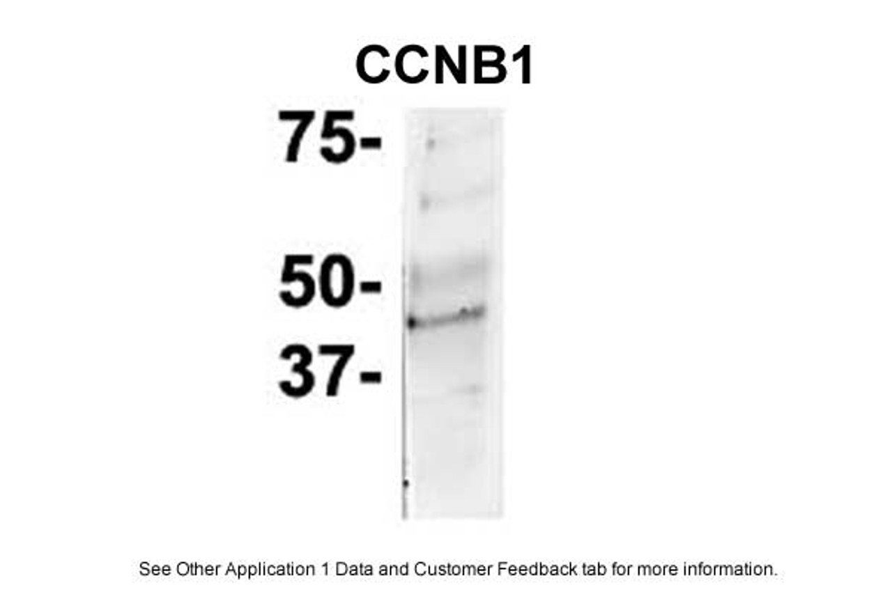 Antibody used in IP on Mouse Brain at: 1:50.