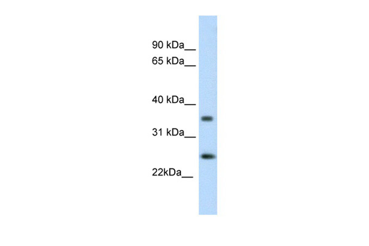Antibody used in WB on Mouse SP2/0 at 0.2-1 ug/ml.