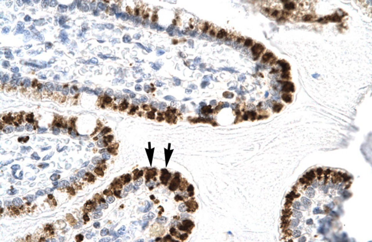 Antibody used in IHC on Human Intestine.