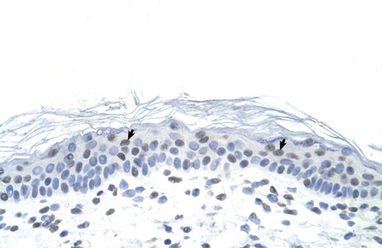 Antibody used in IHC on Human Skin lysate.