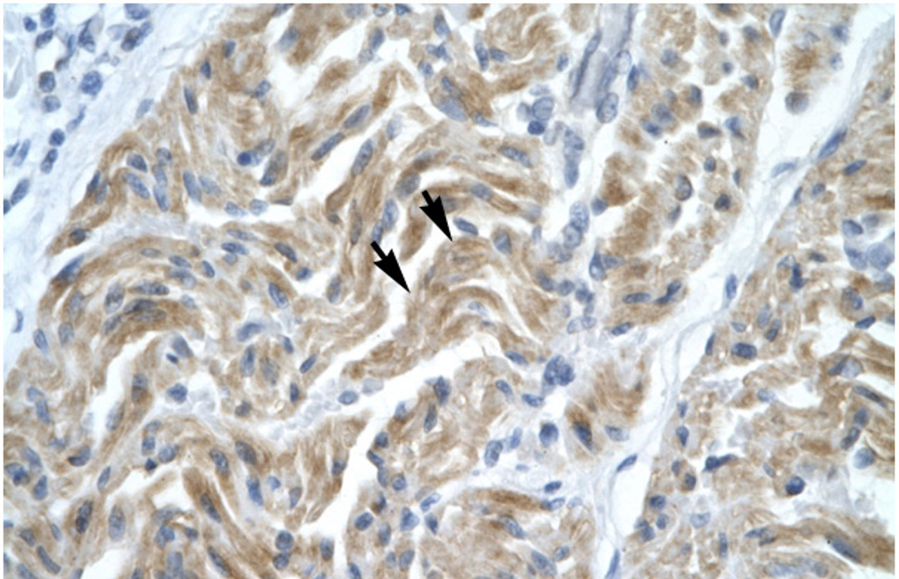 Antibody used in IHC on Human Muscle.