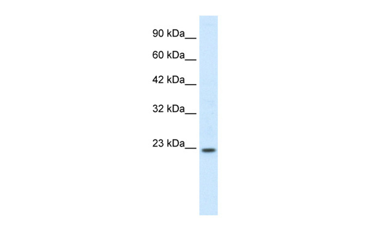 Antibody used in WB on Human Intestine at 0.2-1 ug/ml.