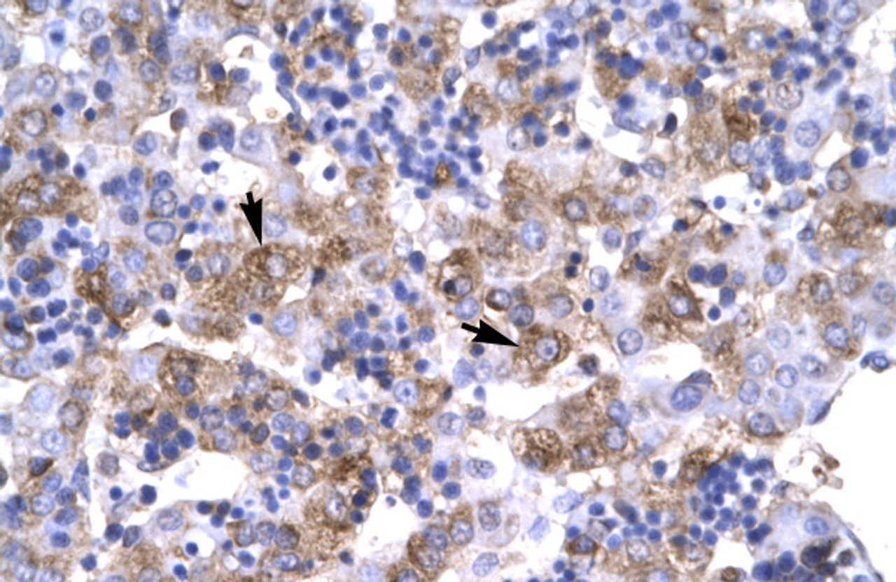 Antibody used in IHC on Human Liver cell lysates at 4.0-8.0 ug/ml.